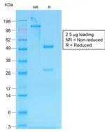 IgG (Immunoglobulin Gamma Heavy Chain) (IGHG) Antibody in SDS-PAGE (SDS-PAGE)