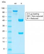 IgG (Immunoglobulin Gamma Heavy Chain) (B-Cell Marker) Antibody in SDS-PAGE (SDS-PAGE)