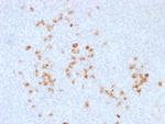 IgG (Immunoglobulin Gamma Heavy Chain) (B-Cell Marker) Antibody in Immunohistochemistry (Paraffin) (IHC (P))