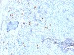 IgG4 (Ig Heavy Constant Gamma 4) (G4m Marker) Antibody in Immunohistochemistry (Paraffin) (IHC (P))