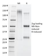 IgG4 (Ig Heavy Constant Gamma 4) (G4m Marker) Antibody in SDS-PAGE (SDS-PAGE)