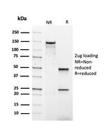 IgG4 (Ig Heavy Constant Gamma 4) Antibody in SDS-PAGE (SDS-PAGE)