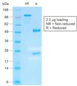 IgG4 (Ig Heavy Constant Gamma 4) Antibody in SDS-PAGE (SDS-PAGE)