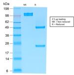 IgM (Immunoglobulin Mu Heavy Chain) Antibody in SDS-PAGE (SDS-PAGE)