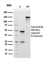 IgM (Immunoglobulin Mu Heavy Chain) Antibody in SDS-PAGE (SDS-PAGE)