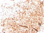 IgM (Immunoglobulin Mu Heavy Chain) (B-Cell Marker) Antibody in Immunohistochemistry (Paraffin) (IHC (P))