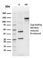 IgM (Immunoglobulin Mu Heavy Chain) (B-Cell Marker) Antibody in SDS-PAGE (SDS-PAGE)