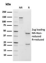 IgM (Immunoglobulin Mu Heavy Chain) Antibody in SDS-PAGE (SDS-PAGE)