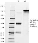 IgM (Immunoglobulin Mu Heavy Chain) (B-Cell Marker) Antibody in SDS-PAGE (SDS-PAGE)