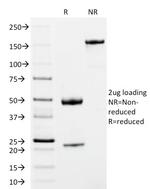 IgM (Immunoglobulin Mu Heavy Chain) (B-Cell Marker) Antibody in SDS-PAGE (SDS-PAGE)