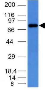 IgM (Immunoglobulin Mu Heavy Chain) (B-Cell Marker) Antibody in Western Blot (WB)