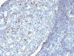 IgM (Immunoglobulin Mu Heavy Chain) (B-Cell Marker) Antibody in Immunohistochemistry (Paraffin) (IHC (P))