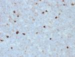 IgM (Immunoglobulin Mu Heavy Chain) (B-Cell Marker) Antibody in Immunohistochemistry (Paraffin) (IHC (P))