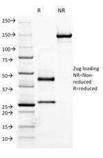 IgM (Immunoglobulin Mu Heavy Chain) (B-Cell Marker) Antibody in SDS-PAGE (SDS-PAGE)