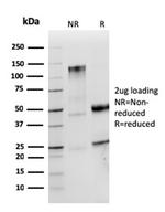 IgM (Immunoglobulin Mu Heavy Chain) Antibody in SDS-PAGE (SDS-PAGE)