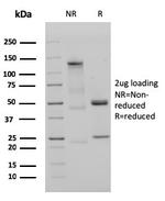 IgM (Immunoglobulin Mu Heavy Chain) Antibody in SDS-PAGE (SDS-PAGE)