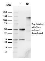 IgM (Immunoglobulin Mu Heavy Chain) Antibody in SDS-PAGE (SDS-PAGE)