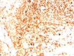 IgM (Immunoglobulin Mu Heavy Chain) (B-Cell Marker) Antibody in Immunohistochemistry (Paraffin) (IHC (P))