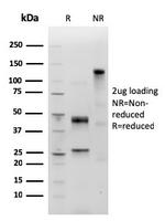 IgM (Immunoglobulin Mu Heavy Chain) (B-Cell Marker) Antibody in SDS-PAGE (SDS-PAGE)