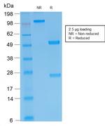 IgM (Immunoglobulin Mu Heavy Chain) Antibody in SDS-PAGE (SDS-PAGE)