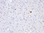 beta Amyloid Antibody in Immunohistochemistry (Paraffin) (IHC (P))