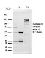 beta Amyloid Antibody in SDS-PAGE (SDS-PAGE)