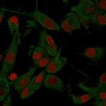 beta Amyloid Antibody in Immunocytochemistry (ICC/IF)