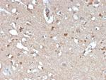 beta Amyloid Antibody in Immunohistochemistry (Paraffin) (IHC (P))