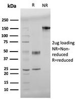 beta Amyloid Antibody in SDS-PAGE (SDS-PAGE)