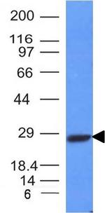 Kappa Light Chain (B-Cell Marker) Antibody in Western Blot (WB)