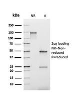 Kappa Light Chain (B-Cell Marker) Antibody in SDS-PAGE (SDS-PAGE)