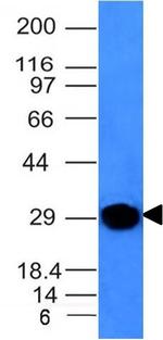 Kappa Light Chain (B-Cell Marker) Antibody in Western Blot (WB)