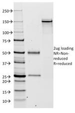 Kappa Light Chain (B-Cell Marker) Antibody in SDS-PAGE (SDS-PAGE)