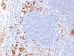 Kappa Light Chain/IGKC Antibody in Immunohistochemistry (Paraffin) (IHC (P))