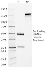 Kappa Light Chain/IGKC Antibody in SDS-PAGE (SDS-PAGE)