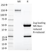 Kappa Light Chain (B-Cell Marker) Antibody in SDS-PAGE (SDS-PAGE)