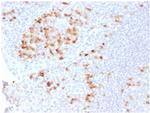 Kappa Light Chain/IGKC Antibody in Immunohistochemistry (Paraffin) (IHC (P))