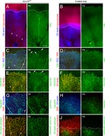 Claudin 5 Antibody in Immunohistochemistry (IHC)