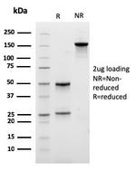 Lambda Light Chain Antibody in SDS-PAGE (SDS-PAGE)