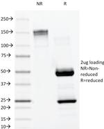 Lambda Light Chain (B-Cell Marker) Antibody in SDS-PAGE (SDS-PAGE)