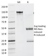 Lambda Light Chain (B-Cell Marker) Antibody in SDS-PAGE (SDS-PAGE)