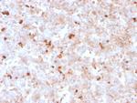 Lambda Light Chain Antibody in Immunohistochemistry (Paraffin) (IHC (P))