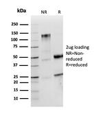 Lambda Light Chain (B-Cell Marker) Antibody in SDS-PAGE (SDS-PAGE)