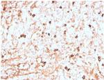 Lambda Light Chain (B-Cell Marker) Antibody in Immunohistochemistry (Paraffin) (IHC (P))