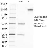 Prostate Specific Antigen (PSA) Antibody in SDS-PAGE (SDS-PAGE)