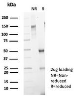 Prostate Specific Antigen (PSA) Antibody in SDS-PAGE (SDS-PAGE)