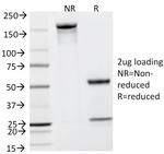 Prostate Specific Antigen (PSA) Antibody in SDS-PAGE (SDS-PAGE)