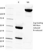 Prostate Specific Antigen (PSA) Antibody in SDS-PAGE (SDS-PAGE)