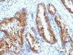 Prostate Specific Antigen (PSA) Antibody in Immunohistochemistry (Paraffin) (IHC (P))