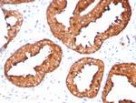 Prostate Specific Antigen (PSA) Antibody in Immunohistochemistry (Paraffin) (IHC (P))